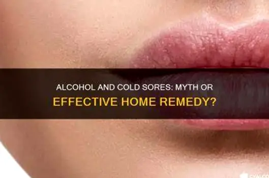 Should You Put Rubbing Alcohol on a Cold Sore?