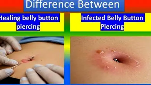 Is Your Belly Button Piercing Infected? Signs and Next Steps