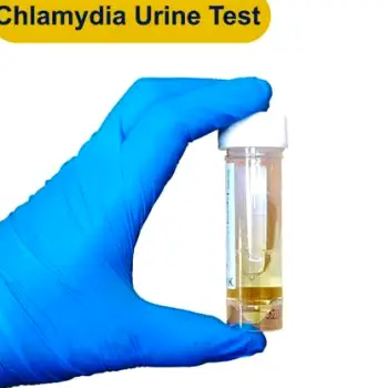 Close-up of a small labeled specimen cup used for collecting a first-catch urine sample