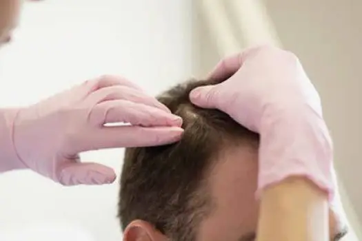 Clinician closely examining a patient's scalp and hair part under bright, consistent lighting.