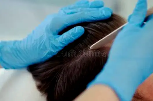 Clinician examining a patient's scalp