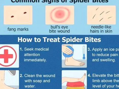 What Common Spider Bites Look Like and When to Seek Care