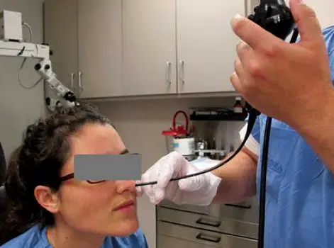 A thin flexible endoscope with a camera tip being passed through the nasal passage to visualize the throat and larynx on a nearby screen.