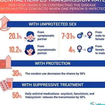 How Herpes Can Spread When Your Partner Has No Symptoms