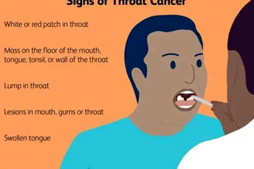 At-Home Throat Cancer Checks: What You Can and Cannot Do