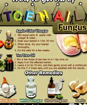 Natural Toenail Fungus Remedies: What May Help and What Won’t