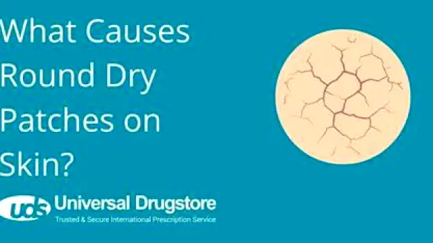Which Medications Can Cause Dry Skin and What Can Help?