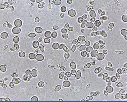 Microscopic view of vaginal secretions showing budding yeast cells
