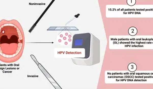 Oral HPV Symptoms, Mouth Growths, and Testing Explained