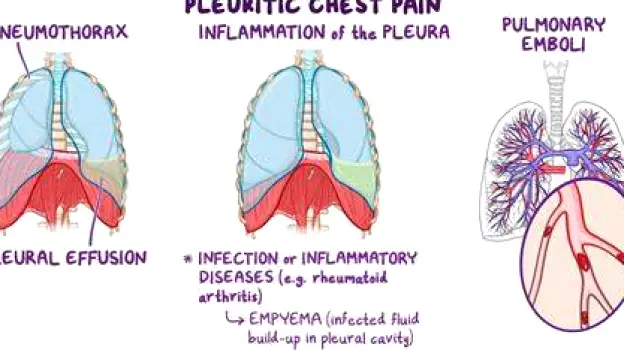 Figure of a person breathing deeply, with a shoulder-height painful region indicated on the upper back