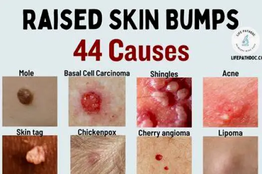 Raised Skin on the Face: Common Causes and Warning Signs