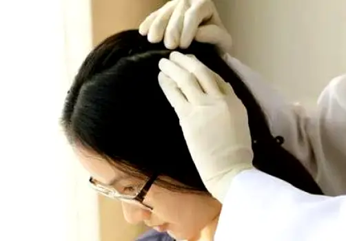Healthcare provider examining a patient's scalp during a clinical examination