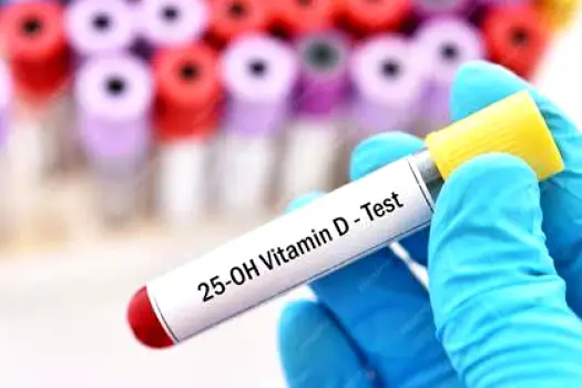 Close-up of a blood test tube labeled 25-hydroxyvitamin D