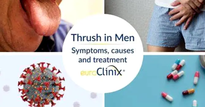 What Causes Thrush in Men? Risk Factors and Warning Signs