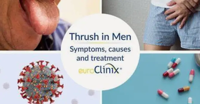 Thrush in Men: Symptoms, Causes, Treatment, and When to Get Help
