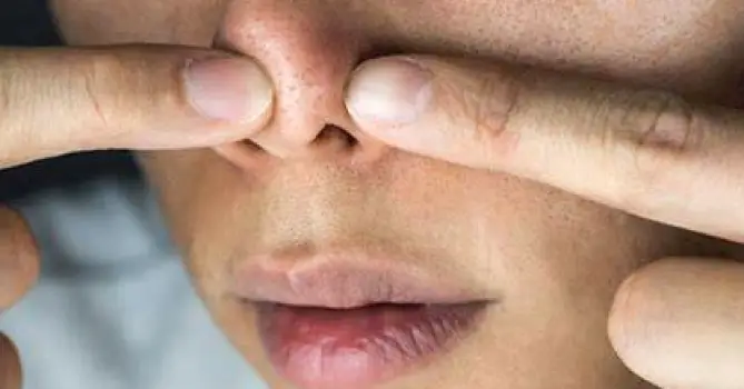 What Is the Worm-Like Material That Comes Out of Nose Pores?
