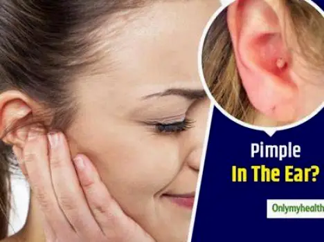 Ear Pimples: Causes, Safe Care, and Signs It May Be Something Else