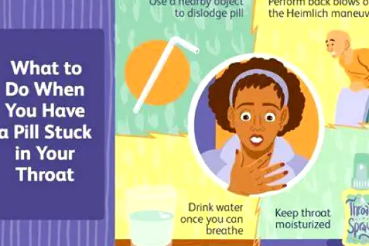 Pill Stuck in Your Throat? Causes, Safe Next Steps, and Warning Signs